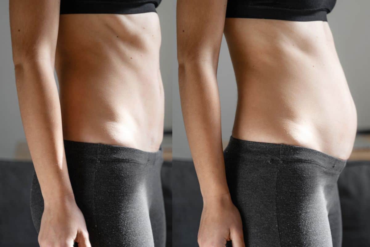How long does diastasis recti take to improve Llanelli?