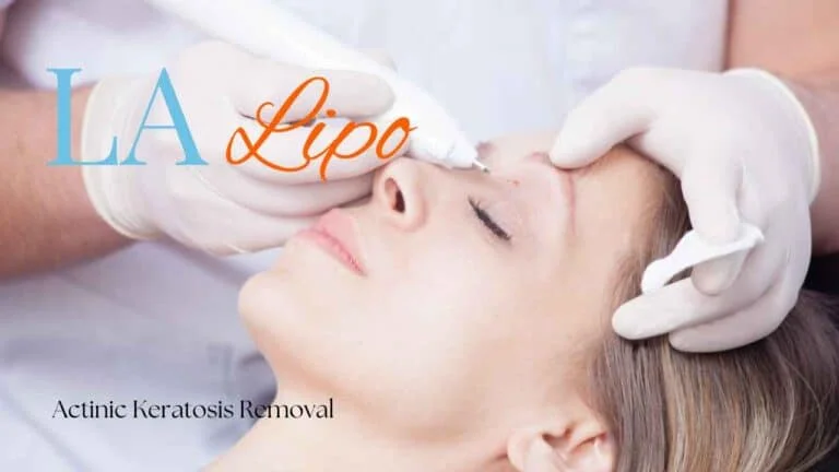 Woman receiving Actinic Keratosis Removal Treatment Llanelli
