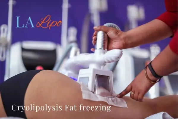 women getting fat freezing Llanelli