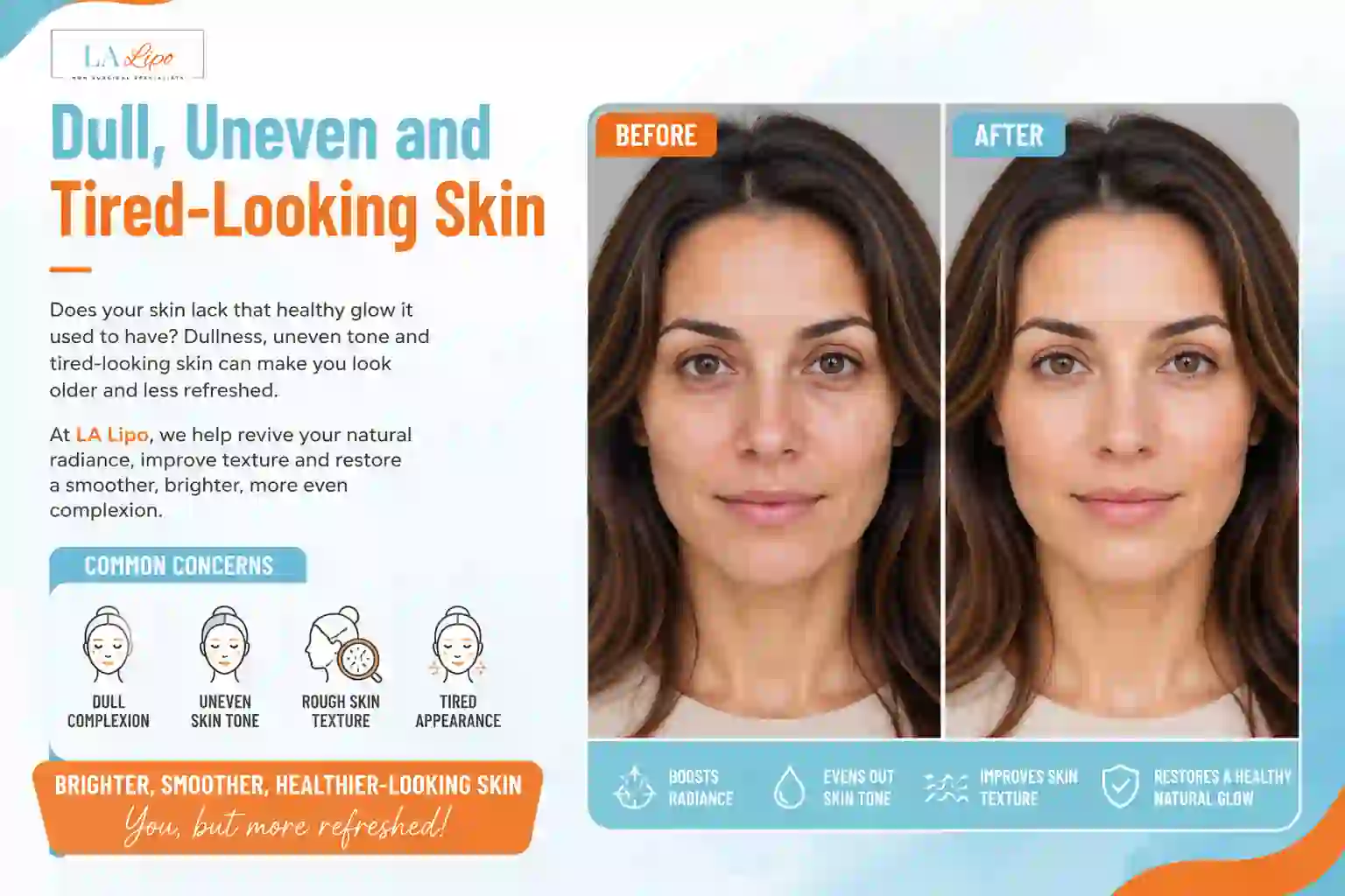 Sign #5: Dull, Uneven and Tired-Looking Skin Llanelli