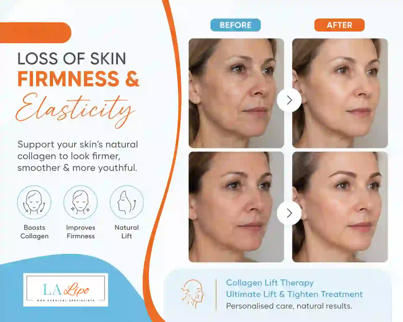 Sign #7: Loss of Skin Firmness and Elasticity Llanelli