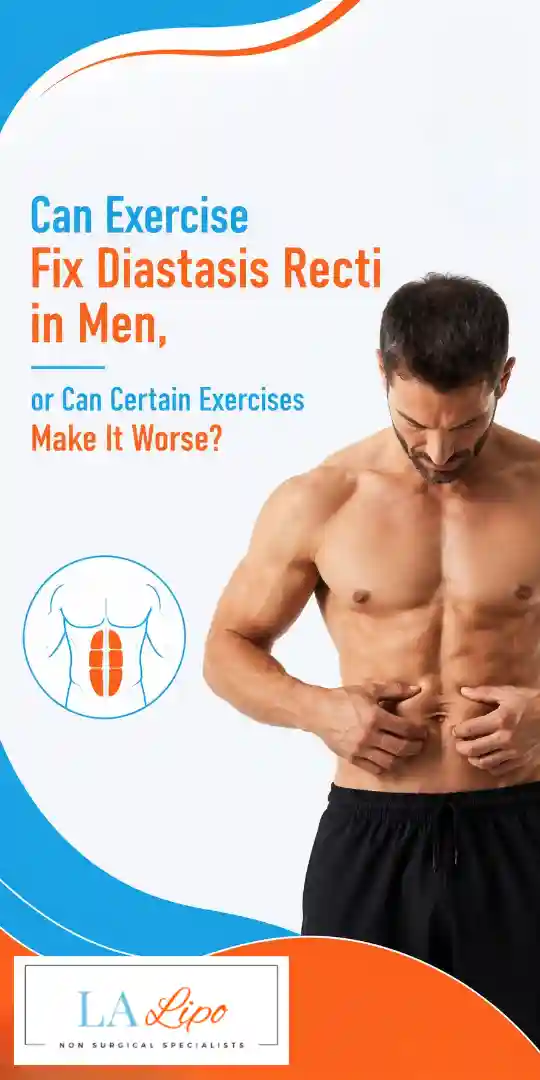 Can Exercise Fix Diastasis Recti in Men, or Can Certain Exercises Make It Worse Llanelli?
